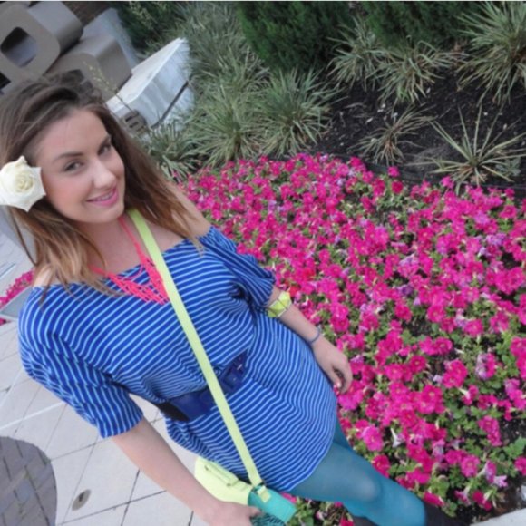 Electric Neon Blue Striped Tunic Dress/Top - Picture 5 of 5